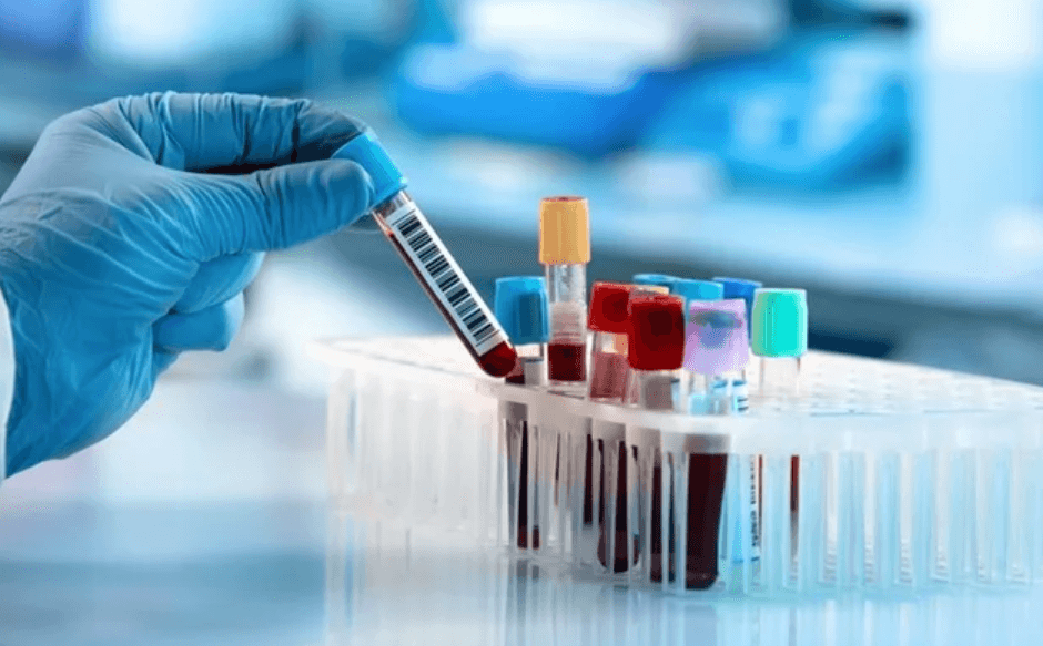 Rapid detection